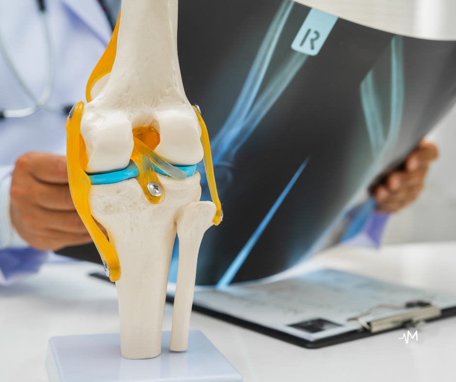 Ventetid for kneprotese i Norge — rettigheter og alternativer
