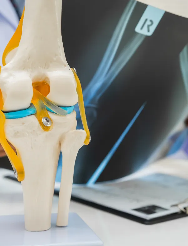 Ventetid for kneprotese i Norge — rettigheter og alternativer