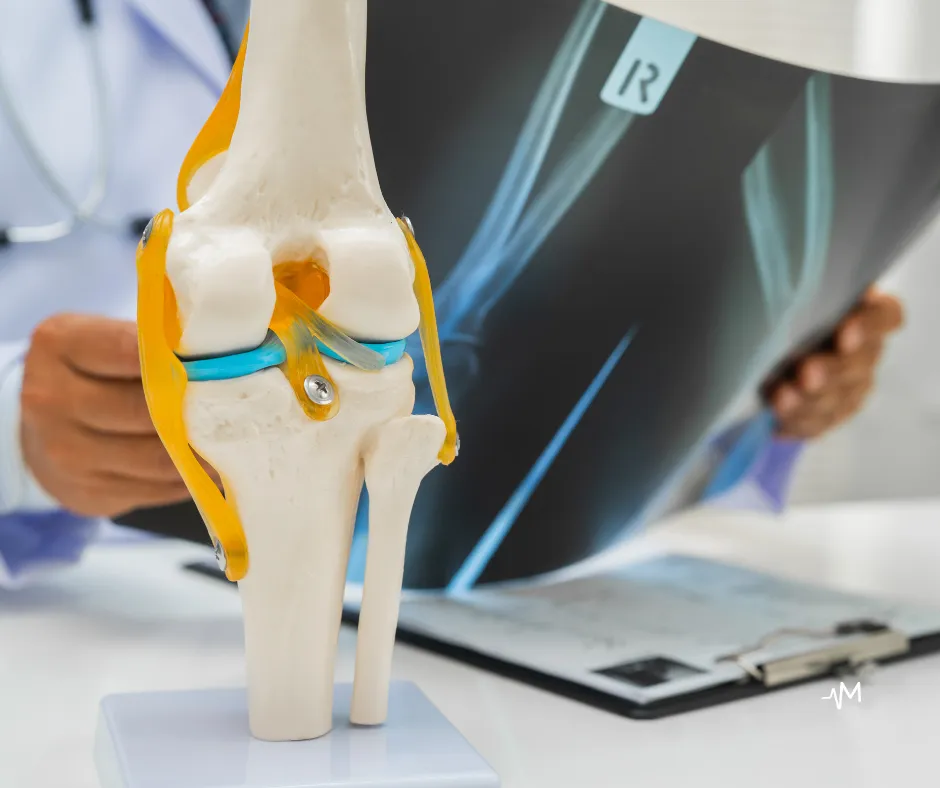 Ventetid for kneprotese i Norge — rettigheter og alternativer